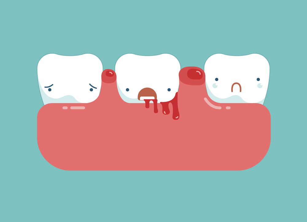 怎么防止牙龈萎缩加重