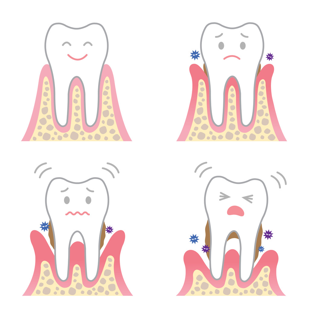 成人牙齿有点松动能恢复吗？深圳看牙周炎哪个医院好？