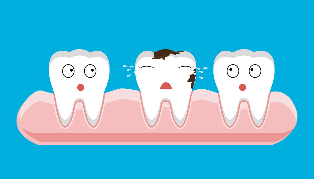 小孩蛀牙严重怎么办？深圳补牙齿洞多少钱？