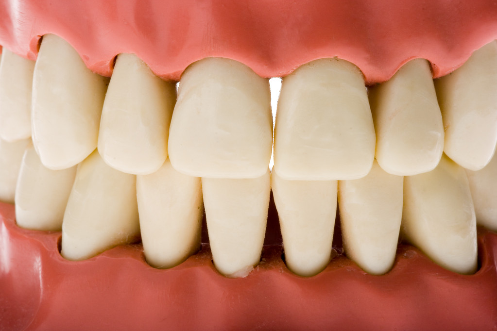 有牙周病可以进行牙齿矫正吗？深圳牙齿松动矫正医院哪个好点？