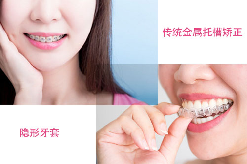 2023年深圳牙醫矯齒箍牙收費價目表