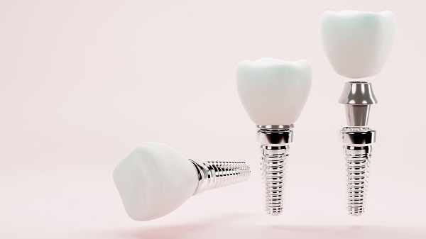 種植牙什麼情況會導致失敗